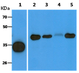 The Recombinant Human ACOT8 (10ng) and Cell lysates (40ug) were resolved by SDS-PAGE, transferred to PVDF membrane and probed with anti-human ACOT8 antibody (1:1000). Proteins were visualized using a goat anti-mouse secondary antibody conjugated to HRP and an ECL detection system.Lane 1.: Recombinant Human ACOT8Lane 2.: Ramos cell lysateLane 3.: A431 cell lysateLane 4 : 293T cell lysateLane 5 : A549 cell lysate