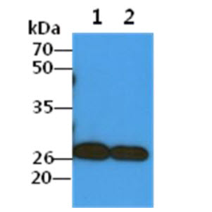 The Cell lysates (40ug) were resolved by SDS-PAGE, transferred to PVDF membrane and probed with anti-human COMMD7 antibody (1:1000). Proteins were visualized using a goat anti-mouse secondary antibody conjugated to HRP and an ECL detection system.Lane 1.: A549 cell lysateLane 2.: HepG2 cell lysate