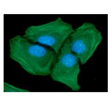 ICC/IF analysis of ACTA2 in HeLa cells line, stained with DAPI (Blue) for nucleus staining and monoclonal anti-human ACTA2 antibody (1:100) with goat anti-mouse IgG-Alexa fluor 488 conjugate (Green).