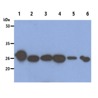 The recombinant human PRDX6 protein (50ng), Cell and Mouse tissue lysates (40ug) were resolved by SDS-PAGE, transferred to PVDF membrane and probed with anti-human Peroxiredoxin 6 antibody (1:1000). Proteins were visualized using a goat anti-mouse secondary antibody conjugated to HRP and an ECL detection system.Lane 1.: Recombinant PRDX6 proteinLane 2.: HeLa cell lysate Lane 3.: 293T cell lysate Lane 4.: HepG2 cell lysate Lane 5.: U87MG cell lysateLane 6.: Ramos cell lysateLane 7.: Mouse brain lysate
