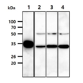 The Recombinant Human LDHB (50ng) and Cell lysates (40ug) were resolved by SDS-PAGE, transferred to PVDF membrane and probed with anti-human LDHB antibody (1:1000). Proteins were visualized using a goat anti-mouse secondary antibody conjugated to HRP and an ECL detection system.Lane 1. : Recombinant LDHB proteinLane 2. : A549 cell lysateLane 3. : 293T cell lysateLane 4. : K562 cell lysateLane 5. : Jurkat cell lysate