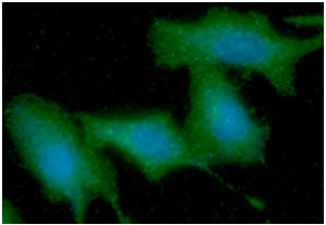 ICC/IF analysis of KRT5 in A549 cells line, stained with DAPI (Blue) for nucleus staining and monoclonal anti-human KRT5 antibody (1:100) with goat anti-mouse IgG-Alexa fluor 488 conjugate (Green).