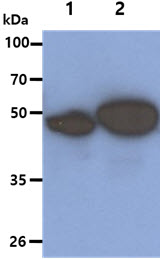 The Cell lysates (40ug) were resolved by SDS-PAGE, transferred to PVDF membrane and probed with anti-human KRT5 antibody (1:1000). Proteins were visualized using a goat anti-mouse secondary antibody conjugated to HRP and an ECL detection system.Lane 1. : HeLa cell lysate Lane 2. : A431 cell lysate