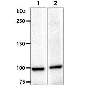 The Cell lysates (40ug) were resolved by SDS-PAGE, transferred to PVDF membrane and probed with anti-human ACTN1 antibody (1:1000). Proteins were visualized using a goat anti-mouse secondary antibody conjugated to HRP and an ECL detection system.Lane 1. : PC-3 cell lysate Lane 2. : Balb/3T3 cell lysate Lane 3. : A549 cell lysate