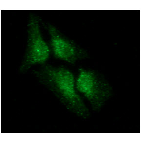 ICC/IF analysis of LSM5 in HeLa cells line, stained with DAPI (Blue) for nucleus staining and monoclonal anti-human LSM5 antibody (1:100) with goat anti-mouse IgG-Alexa fluor 488 conjugate (Green).