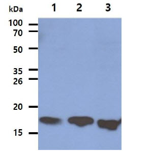 The Cell lysates (40ug) were resolved by SDS-PAGE, transferred to PVDF membrane and probed with anti-human LSM5 antibody (1:1000). Proteins were visualized using a goat anti-mouse secondary antibody conjugated to HRP and an ECL detection system.Lane 1. : HeLa cell lysateLane 2. : K562 cell lysateLane 3. : Jurkat cell lysate