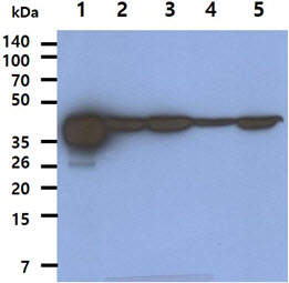 The Recombinant Human AHA1 (50ng) and Cell lysates (40ug) were resolved by SDS-PAGE, transferred to PVDF membrane and probed with anti-human AHA1 antibody (1:1000). Proteins were visualized using a goat anti-mouse secondary antibody conjugated to HRP and an ECL detection system.Lane 1. : AHA1 Recombinant proteinLane 2. : MCF-7 cell lysateLane 3. : PC-3 cell lysateLane 4. : 293T cell lysateLane 5. : HeLa cell lysate