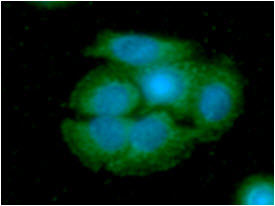 ICC/IF analysis of ARG2 in SW480 cells line, stained with DAPI (Blue) for nucleus staining and monoclonal anti-human ARG2 antibody (1:100) with goat anti-mouse IgG-Alexa fluor 488 conjugate (Green).