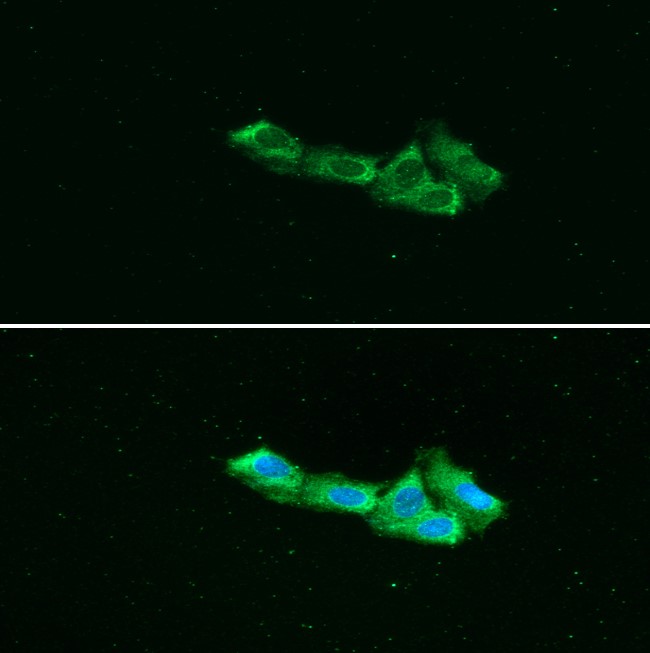 ICC/IF analysis of AIMP1 in Hep3B cells line, stained with DAPI (Blue) for nucleus staining and monoclonal anti-human AIMP1 antibody (1:100) with goat anti-mouse IgG-Alexa fluor 488 conjugate (Green).