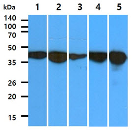 The cell line and tissue lysates (40ug) were resolved by SDS-PAGE, transferred to PVDF membrane and probed with anti-human ALDOC antibody (1:1000). Proteins were visualized using a goat anti-mouse secondary antibody conjugated to HRP and an ECL detection system.Lane 1. : PC3 cell lysateLane 2. : U87MG cell lysateLane 3. : WiDr cell lysateLane 4. : Jurkat cell lysateLane 5. : Mouse brain tissue lysate