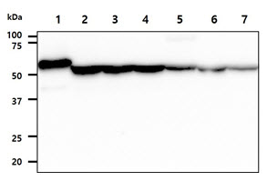 The Recombinant Human ADSL (20ng) and Cell lysates (40ug) were resolved by SDS-PAGE, transferred to PVDF membrane and probed with anti-human ADSL antibody (1:1000). Proteins were visualized using a goat anti-mouse secondary antibody conjugated to HRP and an ECL detection system.Lane 1. : Recombinant Protein Lane 2. : HeLa cell lysate Lane 3. : 293T cell lysate  Lane 4. : Jurkat cell lysate Lane 5. : HepG2 cell lysate  Lane 6. : A549 cell lysate  Lane 7. : MCF7 cell lysate