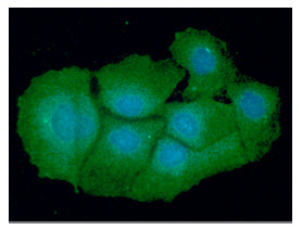 ICC/IF analysis of VTA1 in Hep3B cells line, stained with DAPI (Blue) for nucleus staining and monoclonal anti-human VTA1 antibody (1:100) with goat anti-mouse IgG-Alexa fluor 488 conjugate (Green).