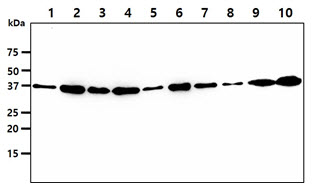 The cell lysates (40ug) were resolved by SDS-PAGE, transferred to PVDF membrane and probed with anti-human VTA1 antibody (1:1000). Proteins were visualized using a goat anti-mouse secondary antibody conjugated to HRP and an ECL detection system.Lane 1.: HepG2 cell lysateLane 2.: 293T cell lysate Lane 3.: HeLa cell lysate Lane 4.: MCF7 cell lysate Lane 5.: A549 cell lysate Lane 6.: Jurkat cell lysate Lane 7.: K562 cell lysate Lane 8.: LnCaP cell lysate Lane 9.: U937 cell lysate Lane 10.: A431 cell lysate