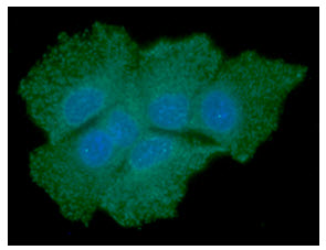 ICC/IF analysis of SOD1 in Hep3B cells line, stained with DAPI (Blue) for nucleus staining and monoclonal anti-human SOD1 antibody (1:100) with goat anti-mouse IgG-Alexa fluor 488 conjugate (Green).