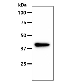 The MCF-7 cell lysate (40ug) were resolved by SDS-PAGE, transferred to PVDF membrane and probed with anti-human ASS1 antibody (1:500). Proteins were visualized using a goat anti-mouse secondary antibody conjugated to HRP and an ECL detection system.