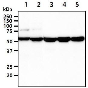 The cell lysates (40ug) were resolved by SDS-PAGE, transferred to PVDF membrane and probed with anti-human UGDH antibody (1:1000). Proteins were visualized using a goat anti-mouse secondary antibody conjugated to HRP and an ECL detection system.Lane 1.: HeLa cell lysateLane 2.: NIH-3T3 cell lysate Lane 3.: HepG2 cell lysate Lane 4.: A549 cell lysate Lane 5.: MCF7 cell lysate