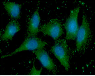 ICC/IF analysis of S100A11 in A549 cells line, stained with DAPI (Blue) for nucleus staining and monoclonal anti-human   S100A11 antibody (1:100) with goat anti-mouse IgG-Alexa fluor 488 conjugate (Green).