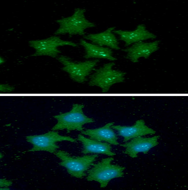 ICC/IF analysis of FKBP14 in HeLa cells line, stained with DAPI (Blue) for nucleus staining and monoclonal anti-human   FKBP14 antibody (1:100) with goat anti-mouse IgG-Alexa fluor 488 conjugate (Green).