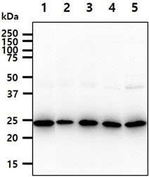 The cell lysates (40ug) were resolved by SDS-PAGE, transferred to PVDF membrane and probed with anti-human BAG2 antibody (1:1000). Proteins were visualized using a goat anti-mouse secondary antibody conjugated to HRP and an ECL detection system.Lane 1.: Jurkat cell lysateLane 2.: A549 cell lysate Lane 3.: K562 cell lysate Lane 4.: HepG2 cell lysate Lane 5.: HeLa cell lysate 