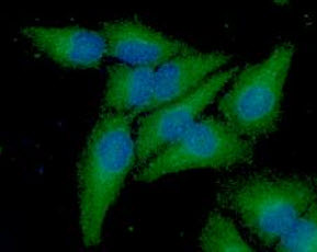 ICC/IF analysis of Frataxin in A549 cell line, stained with DAPI (Blue) for nucleus staining and monoclonal anti-human      Frataxin antibody (1:100) with goat anti-mouse IgG-Alexa fluor 488 conjugate (Green).