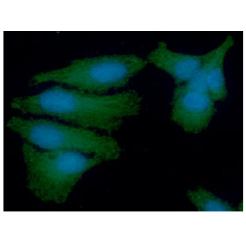 ICC/IF analysis of PSMD11 in HeLa cells line, stained with DAPI (Blue) for nucleus staining and monoclonal anti-human PSMD11 antibody (1:100) with goat anti-mouse IgG-Alexa fluor 488 conjugate (Green).