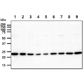 The cell lysates (40ug) were resolved by SDS-PAGE, transferred to PVDF membrane and probed with anti-human AK1 antibody (1:1000). Proteins were visualized using a goat anti-mouse secondary antibody conjugated to HRP and an ECL detection system.Lane 1.: HeLa cell lysateLane 2.: U87-MG cell lysate Lane 3.: K562 cell lysate Lane 4.: 293T cell lysate Lane 5.: HepG2 cell lysate Lane 6.: A549 cell lysate Lane 7.: MCF7cell lysate Lane 8.: SK-OV-3 cell lysate Lane 9.: PC3 cell lysate 