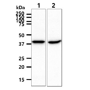 The cell lysate (40ug) were resolved by SDS-PAGE, transferred to PVDF membrane and probed with anti-human ACADS antibody (1:1000). Proteins were visualized using a goat anti-mouse secondary antibody conjugated to HRP and an ECL detection system.Lane 1 : HepG2 cell lysateLane 2 : LnCap cell lysate