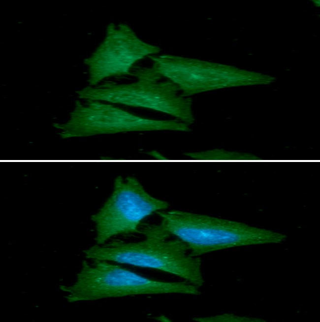 ICC/IF analysis of Leptin in HeLa cells line, stained with DAPI (Blue) for nucleus staining and monoclonal anti-human Leptin antibody (1:100) with goat anti-mouse IgG-Alexa fluor 488 conjugate (Green)