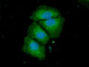 ICC/IF analysis of ACSF2 in HeLa cells line, stained with DAPI (Blue) for nucleus staining and monoclonal anti-human ACSF2 antibody (1:100) with goat anti-mouse IgG-Alexa fluor 488 conjugate (Green)