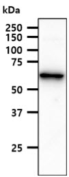 The HepG2 cell lysate (40ug) were resolved by SDS-PAGE, transferred to PVDF membrane and probed with anti-human ACSF2 antibody (1:1000). Proteins were visualized using a goat anti-mouse secondary antibody conjugated to HRP and an ECL detection system.