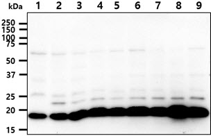 The cell lysates (40ug) were resolved by SDS-PAGE, transferred to PVDF membrane and probed with anti-human SSU72 antibody (1:1000). Proteins were visualized using a goat anti-mouse secondary antibody conjugated to HRP and an ECL detection system.Lane 1.: Jurkat cell lysateLane 2.: K562 cell lysate Lane 3.: 293T cell lysate Lane 4.: HepG2 cell lysate  Lane 5.: A549 cell lysateLane 6.: MCF-7 cell lysate Lane 7.: SK-OV-3 cell lysate Lane 8.: LnCap cell lysate Lane 9.: HeLa cell lysate