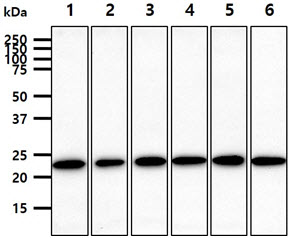 The cell lysates (40ug) were resolved by SDS-PAGE, transferred to PVDF membrane and probed with anti-human RAB7A antibody (1:1000). Proteins were visualized using a goat anti-mouse secondary antibody conjugated to HRP and an ECL detection system.Lane 1.: HeLa cell lysateLane 2.: Jurkat cell lysate Lane 3.: MCF7 cell lysate Lane 4.: PC3 cell lysateLane 5.: 293T cell lysateLane 6.: SK-OV-3 cell lysate