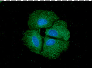ICC/IF analysis of PPID in Hep3B cells. The cell was stained with ATGA0473 (1:100). The secondary antibody (green) was used Alexa Fluor 488. DAPI was stained the cell nucleus (blue).