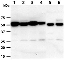 The cell and tissue lysates (40ug) were resolved by SDS-PAGE, transferred to PVDF membrane and probed with anti-human DKK3 antibody (1:1000). Proteins were visualized using a goat anti-mouse secondary antibody conjugated to HRP and an ECL detection system.Lane 1.: 293T cell lysateLane 2.: HepG2 cell lysate Lane 3.: MCF7 cell lysate Lane 4.: A549 cell lysate Lane 5.: Mouse brain tissue lysate Lane 6.: Mouse kidney tissue lysate