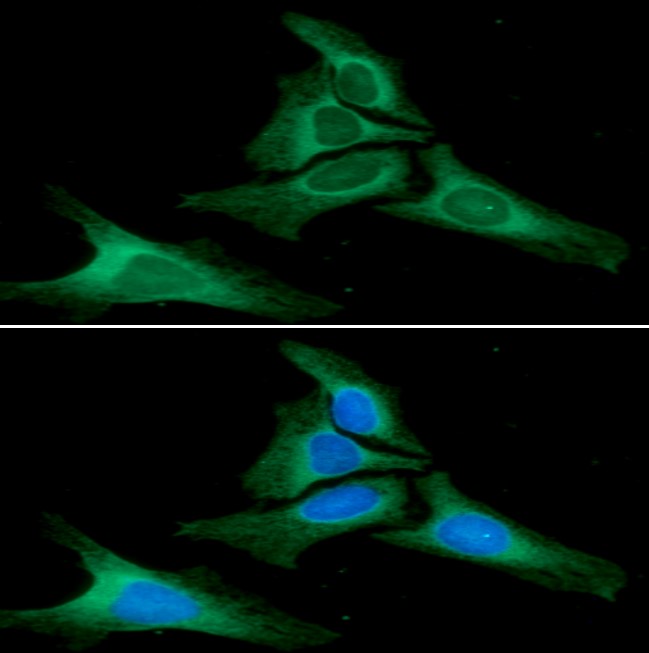 ICC/IF analysis of Calnexin in HeLa cells. The cell was stained with ATGA0483 (1:100). The secondary antibody (green) was used Alexa Fluor 488. DAPI was stained the cell nucleus (blue).