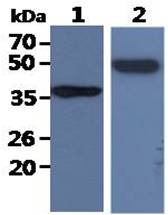 All lanes : PC-3 Whole Cell Lysate (40ug);;Lane 1. : Anti-GAPDH antibody (ATGA0181);;Lane 2. : Anti-Beta tubulin antibody (ATGA0196) {ATGL0004-WB.jpg}