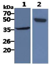 All lanes : A431 Whole Cell Lysate (40ug);;Lane 1. : Anti-GAPDH antibody (ATGA0181);;Lane 2. : Anti-Beta tubulin antibody (ATGA0196) {ATGL0007-WB.jpg}