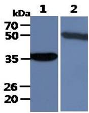 All lanes : A549 Whole Cell Lysate (40ug);;Lane 1. : Anti-GAPDH antibody (ATGA0181);;Lane 2. : Anti-Beta tubulin antibody (ATGA0196) {ATGL0008-WB.jpg}