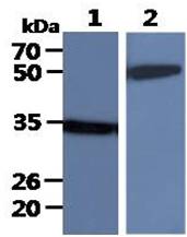 All lanes : MCF-7 Whole Cell Lysate (40ug);;Lane 1. : Anti-GAPDH antibody (ATGA0181);;Lane 2. : Anti-Beta tubulin antibody (ATGA0196) {ATGL0009-WB.jpg}