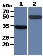 All lanes : LnCaP Whole Cell Lysate (40ug);;Lane 1. : Anti-GAPDH antibody (ATGA0181);;Lane 2. : Anti-Beta tubulin antibody (ATGA0196) {ATGL0014-WB.jpg}
