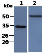 All lanes : HaCaT Whole Cell Lysate (40ug);;Lane 1. : Anti-GAPDH antibody (ATGA0181);;Lane 2. : Anti-Beta tubulin antibody (ATGA0196) {ATGL0015-WB.jpg}