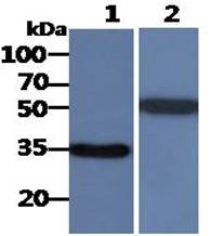 All lanes : WiDr Whole Cell Lysate (40ug);;Lane 1. : Anti-GAPDH antibody (ATGA0181);;Lane 2. : Anti-Beta tubulin antibody (ATGA0196) {ATGL0020-WB.jpg}