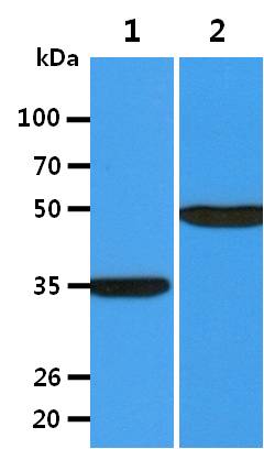 All lanes : TE-2 Whole Cell Lysate (40ug);;Lane 1. : Anti-GAPDH antibody (ATGA0181);;Lane 2. : Anti-Beta tubulin antibody (ATGA0196) {ATGL0024-WB.jpg}