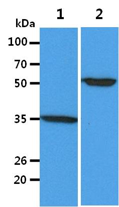 All lanes : K562 Whole Cell Lysate (40ug);;Lane 1. : Anti-GAPDH antibody (ATGA0181);;Lane 2. : Anti-Beta tubulin antibody (ATGA0196) {ATGL0029-WB.jpg}