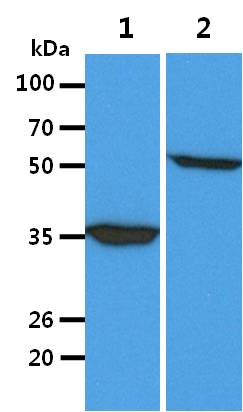 All lanes : AGS Whole Cell Lysate (40ug);;Lane 1. : Anti-GAPDH antibody (ATGA0181);;Lane 2. : Anti-Beta tubulin antibody (ATGA0196) {ATGL0030-WB.jpg}