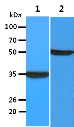 All lanes : HT1080 Whole Cell Lysate (40ug);;Lane 1. : Anti-GAPDH antibody (ATGA0181);;Lane 2. : Anti-Beta tubulin antibody (ATGA0196) {ATGL0032-WB.jpg}