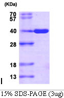 3ug by SDS-PAGE under reducing condition and visualized by coomassie blue stain.