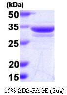 3ug by SDS-PAGE under reducing condition and visualized by coomassie blue stain.