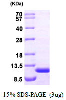 3ug by SDS-PAGE under reducing condition and visualized by coomassie blue stain.