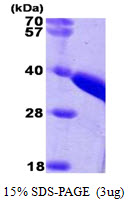 3ug by SDS-PAGE under reducing condition and visualized by coomassie blue stain.